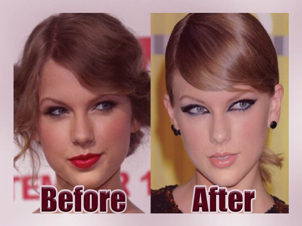 Taylor Swift Before & After Plastic Surgery Look